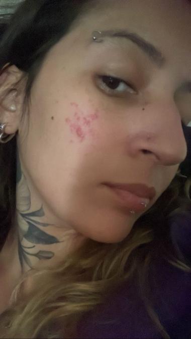 Pele com espinhas